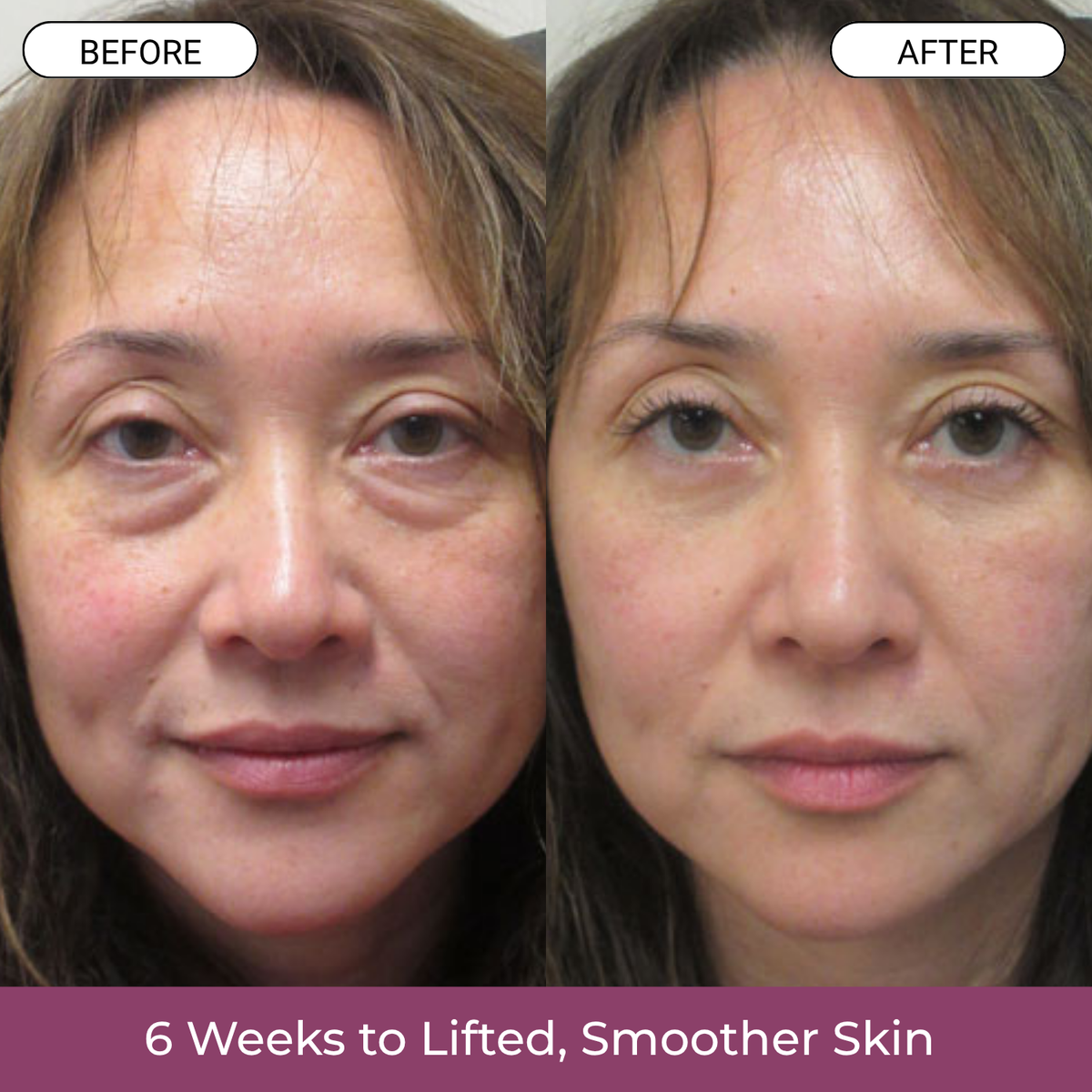 Korean Skincare Lift Balm*
