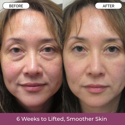 Korean Skincare Lift Balm*